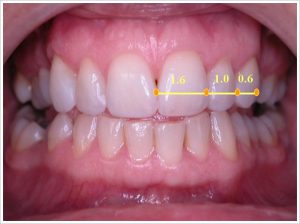 زیبایی دندان،از واقعیت تا توهم قسمت دوم-مقالات وبسایت دکتر افشین کاوسی