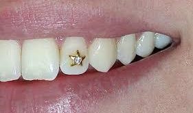 زیبایی دندان،از واقعیت تا توهم قسمت اول-مقالات وبسایت دکتر افشین کاوسی