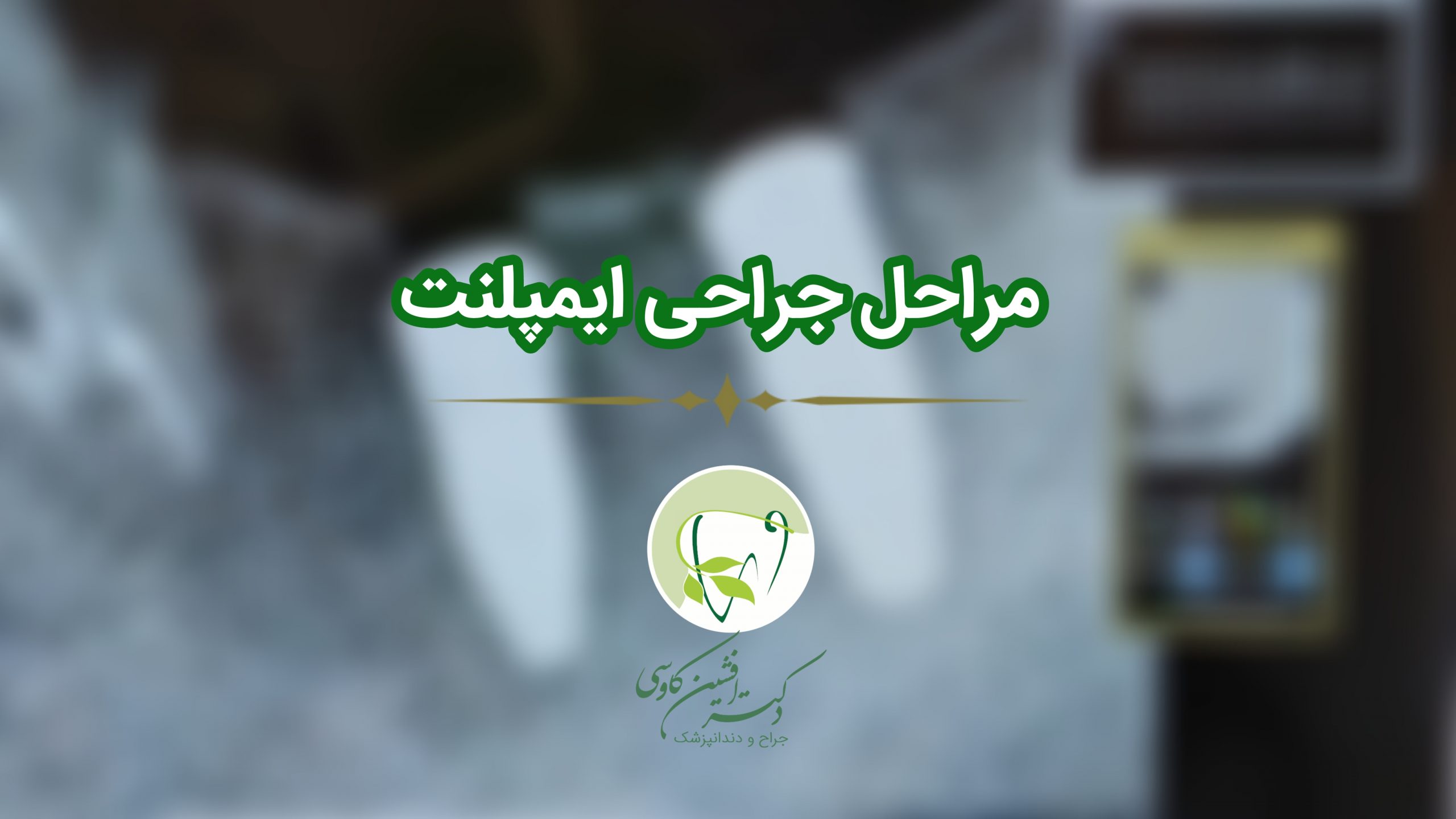 مراحل جراحی ایمپلنت - گالری ویدیو وبسایت دکتر افشین کاوسی