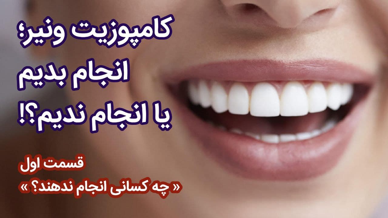 ونیر کامپوزیت انجام بدیم یا انجام ندیم؟ - گالری ویدیوی وبسایت دکتر افشین کاوسی