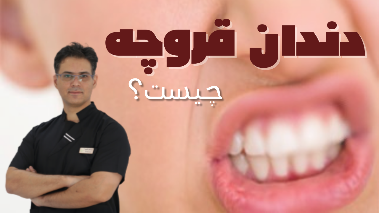علت ابتلا به دندان قروچه و راه کنترل و درمان آن