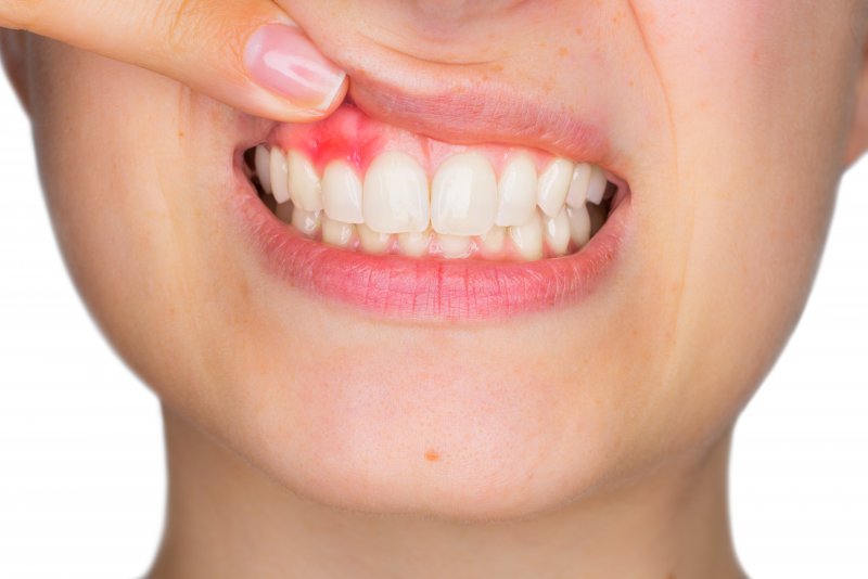 عوامل ایجاد سرطان دهان،فک و صورت - وبسایت دکتر افشین کاوسی